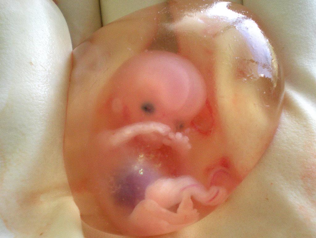 10-week-fetus21.jpg