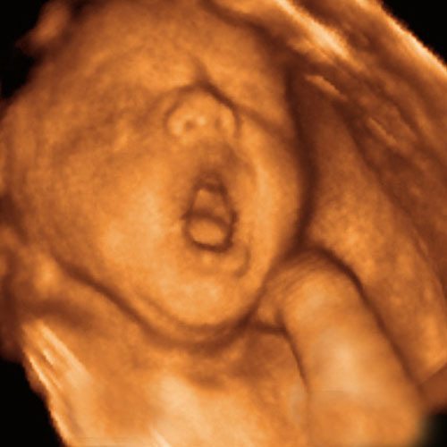 42-weeks-pregnant-ultrasound-2.jpg